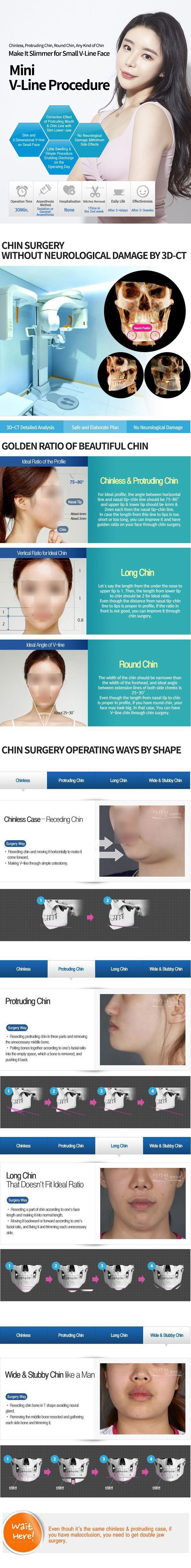 Chin Reduction & Implant Surgery (Before And After)