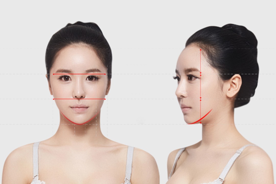 Non-surgical V-line Lift to get a ‘Baby Face’… It’s Up to Ultrasonic Diagnosis