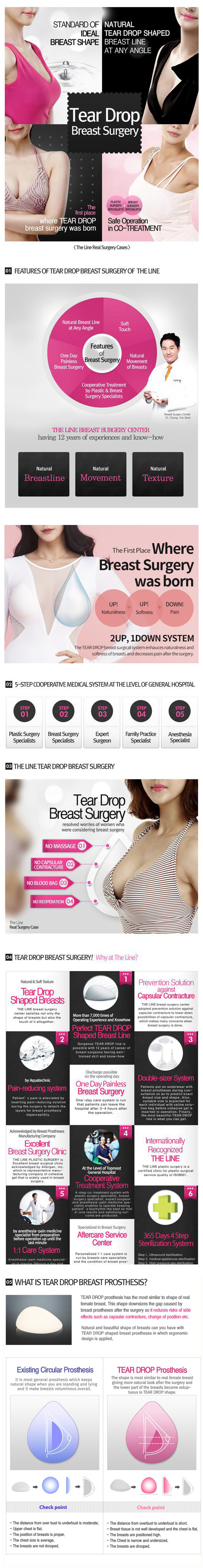 Teardrop Breast Surgery Korea